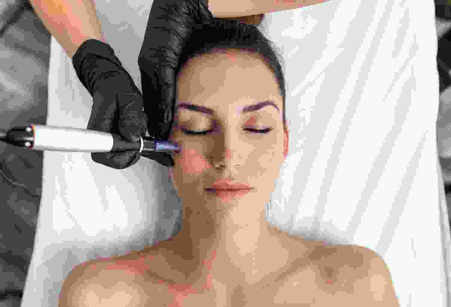 Laser Facial Treatment